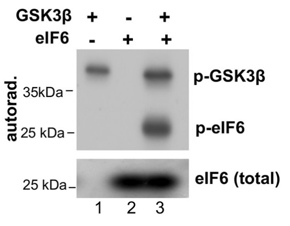 In vitro kinase reactions were carried out in the presence and absence of recombinant full-length human eIF6 and GSK3β.jpg